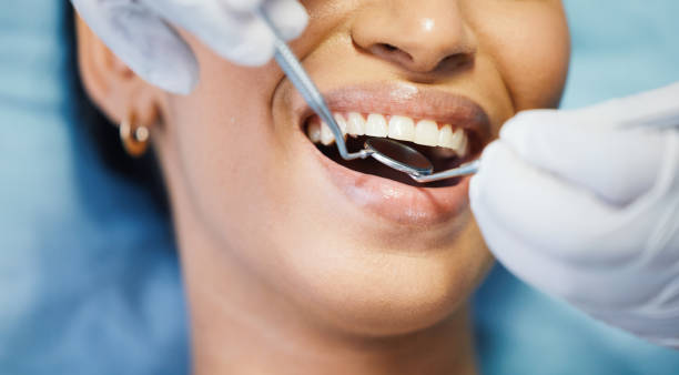 Best Emergency Tooth Extraction in Alorton, IL
