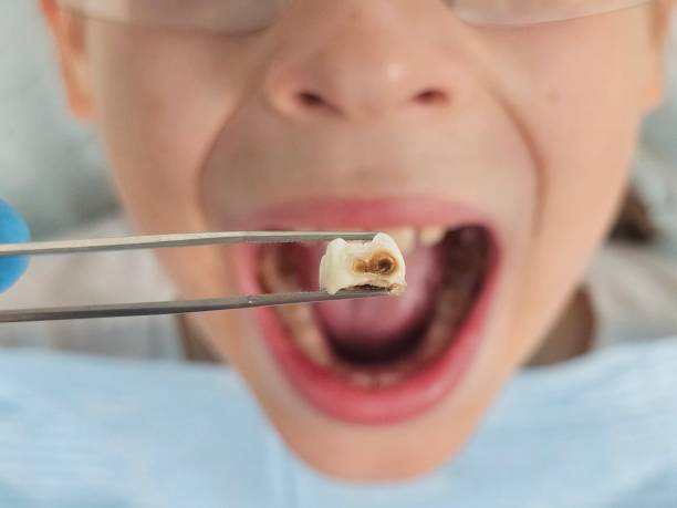 Best Weekend Emergency Dentist in Alorton, IL